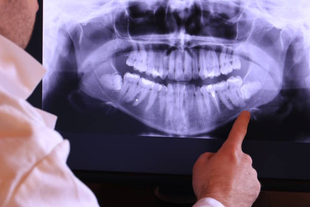 Best Root Canal Emergency Dentist  in Richwood, LA
