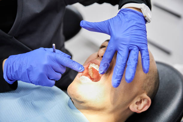 Best Dentist for Tooth Abscess  in Richwood, LA
